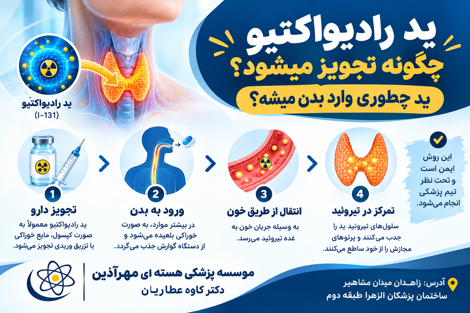 ید رادیواکتیو چگونه تجویز میشود؟ ید چطوری وارد بدن میشه؟